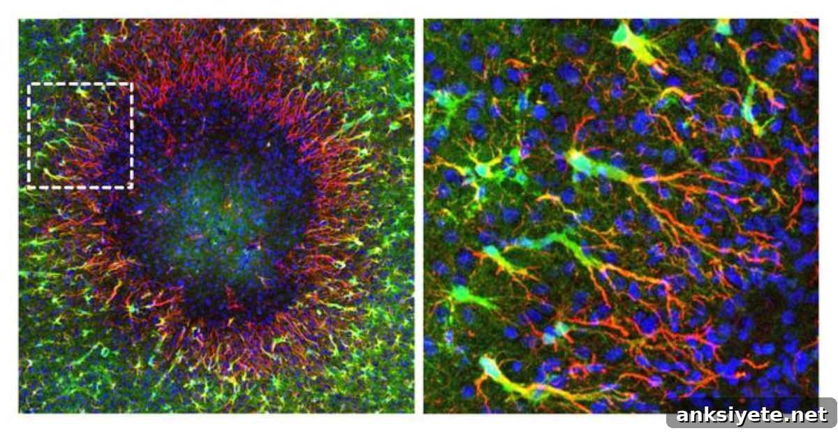 This shows the astrocytes repairing damaged tissue in the brain.