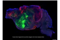 Lab-Grown Human Brain Tissue Restores Neural Circuits in Mice