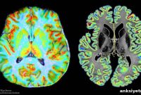 Imaging Index Shows Blood Flow Linked to Cell Architecture