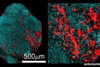 How Reactive Astrocytes Drive Childhood Epilepsy
