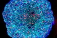 APOE4 Damages Brain Vessels and Blocks Waste Clearance